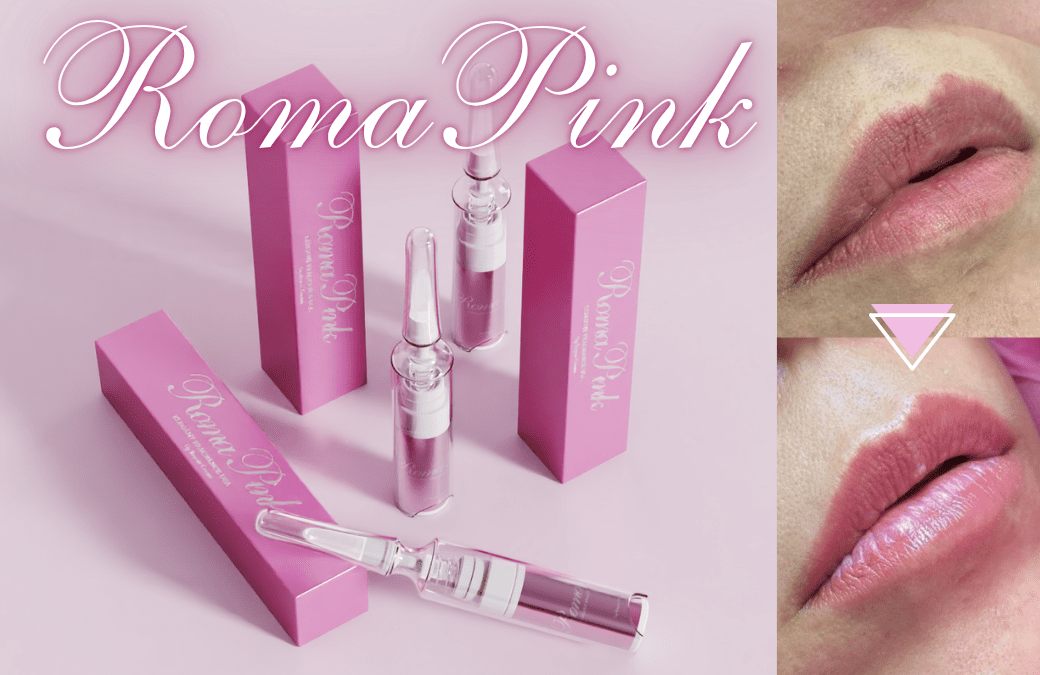 岡谷市のローマピンク施術（色素沈着ケア）のイメージ